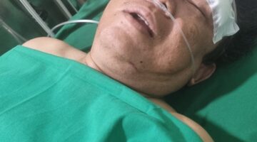 Brutal! Jurnalis Dedi Yusuf Dibacok OTK di Aceh Besar, IWOI: Ini Serangan terhadap Kebebasan Pers